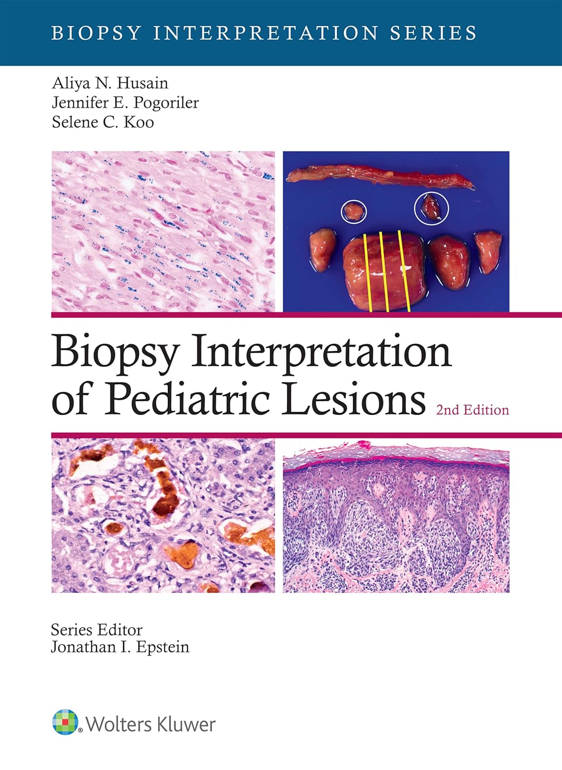 Biopsy Interpretation of Pediatric Lesions 2nd Edition