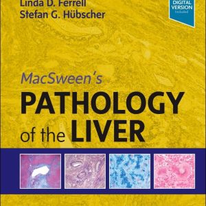 MacSween’s Pathology of the Liver 8th Edition
