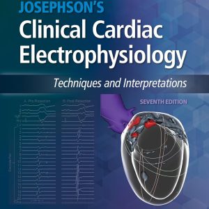 Josephson’s Clinical Cardiac Electrophysiology 7th Edition