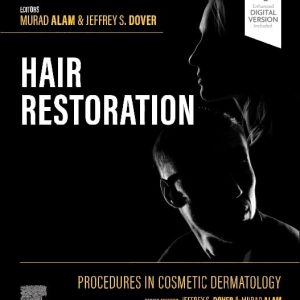 Procedures in Cosmetic Dermatology: Hair Restoration