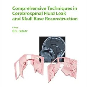 Comprehensive Techniques in CSF LEAK Repair and Skull Base Reconstruction